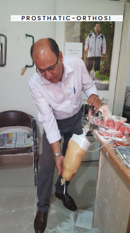Prosthetic Leg — prosthetic fabrication and fitting