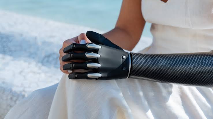 Aether Biomedical prosthetic hand — daily activities