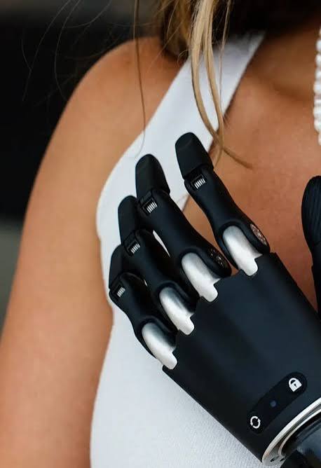 Aether Biomedical prosthetic hand — upper-limb solution