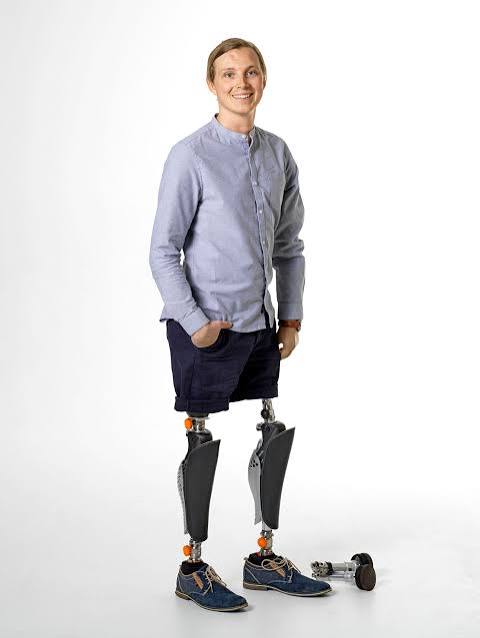 Prosthetic Leg — bilateral prosthetic legs