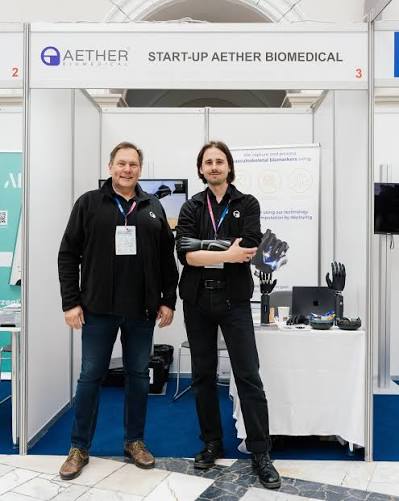 Aether Biomedical prosthetic hand — fitting