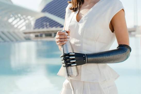 Aether Biomedical prosthetic hand — grip demonstration